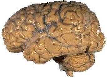 File:Human brain NIH.jpg
