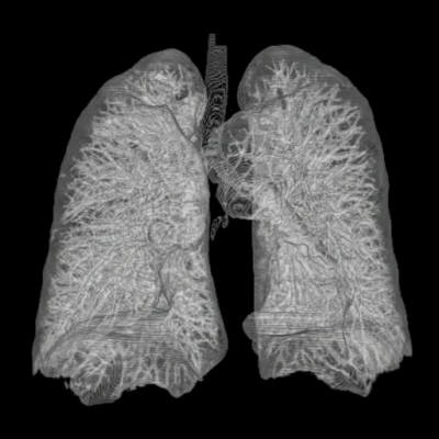 File:Thorax Lung 3d from ct scans.jpg