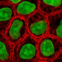 File:Epithelial-cells.jpg