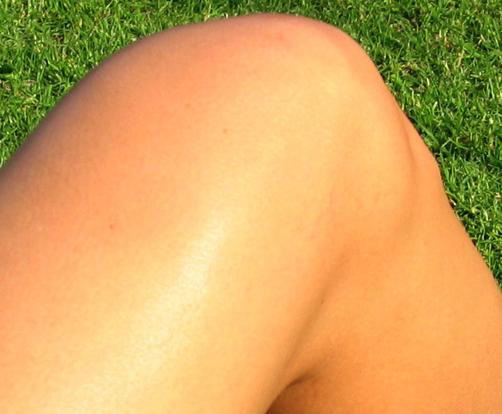 File:Knee.female.jpg